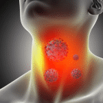 Боль в горле: основные причины и способы лечения